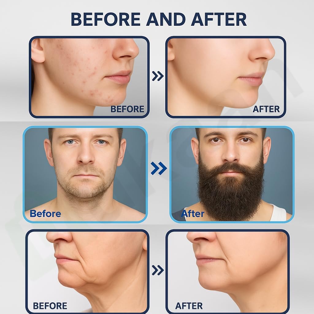 Derma Stamp for Hair & Beard Care – Microneedling Scalp & Beard Grooming Tool | Pack of 1